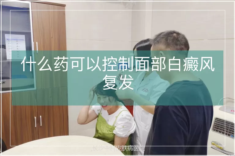 什么药可以控制面部白癜风复发