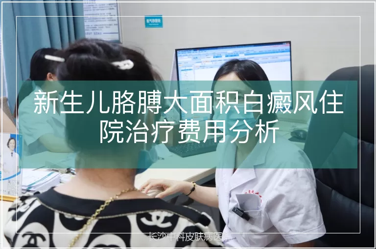 新生儿胳膊大面积白癜风住院治疗费用分析