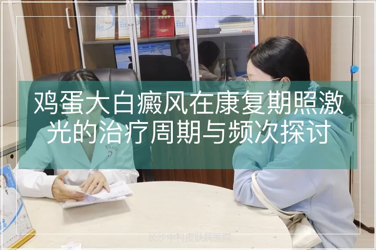 鸡蛋大白癜风在康复期照激光的治疗周期与频次探讨