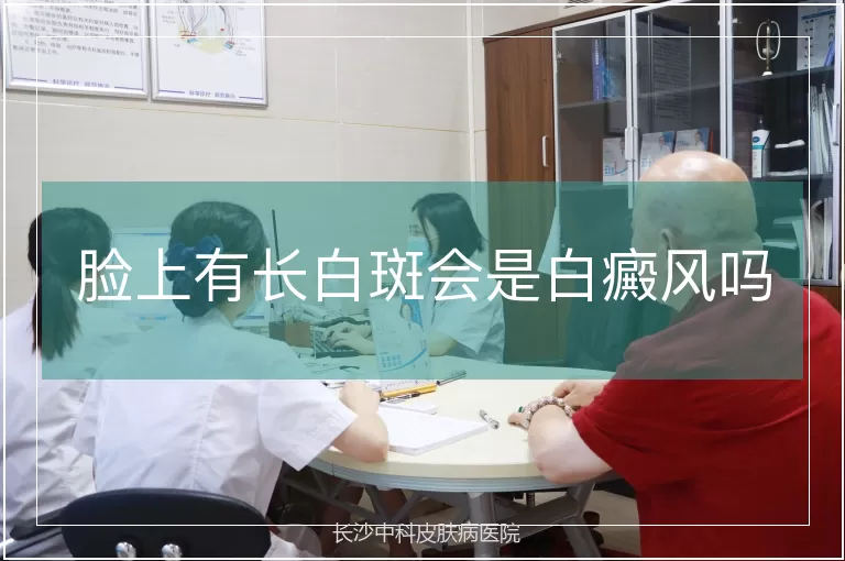脸上有长白斑会是白癜风吗