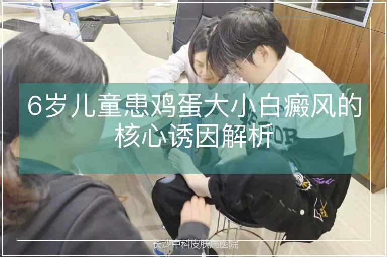 6岁儿童患鸡蛋大小白癜风的核心诱因解析