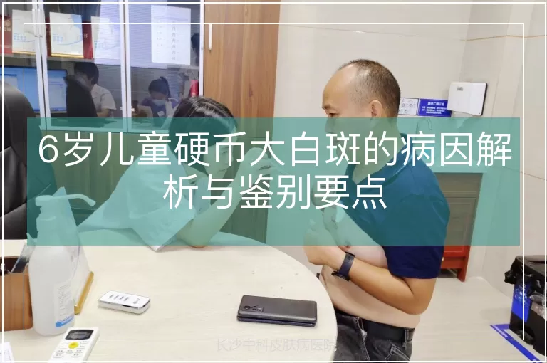 6岁儿童硬币大白斑的病因解析与鉴别要点