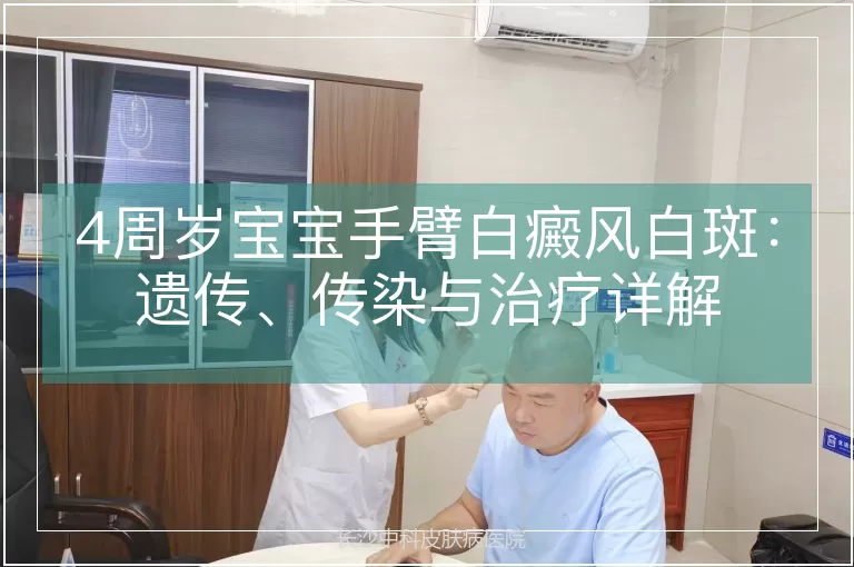 4周岁宝宝手臂白癜风白斑：遗传、传染与治疗详解