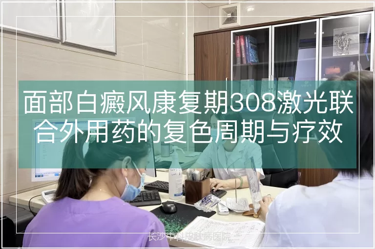 面部白癜风康复期308激光联合外用药的复色周期与疗效优化策略