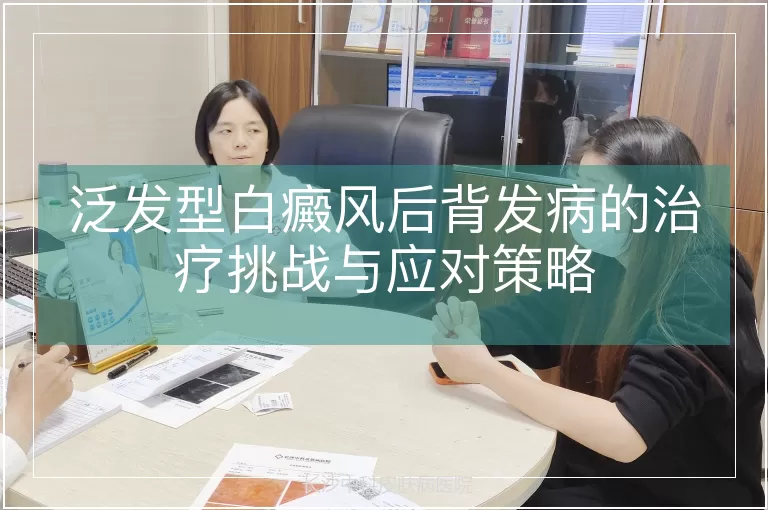 泛发型白癜风后背发病的治疗挑战与应对策略