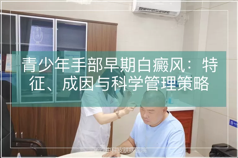 青少年手部早期白癜风：特征、成因与科学管理策略