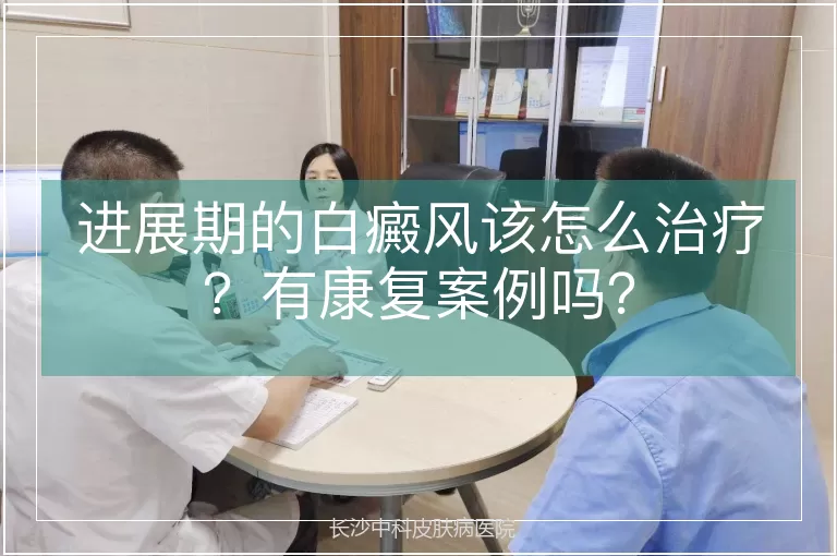 进展期的白癜风该怎么治疗？有康复案例吗？