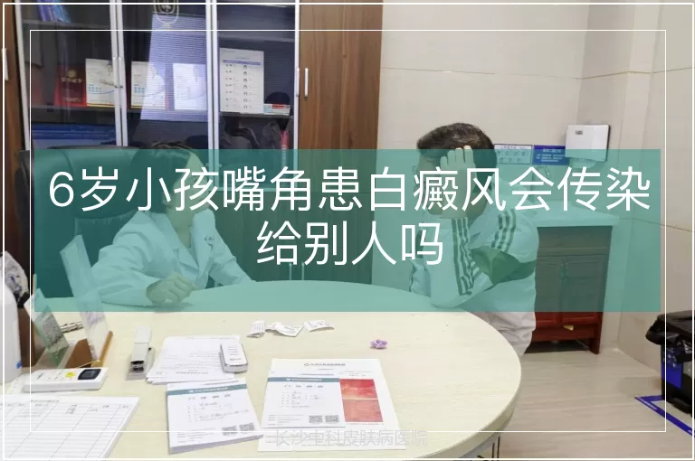 6岁小孩嘴角患白癜风会传染给别人吗