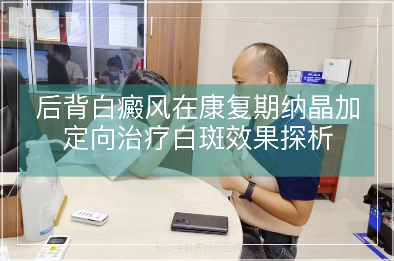 后背白癜风在康复期纳晶加定向治疗白斑效果探析