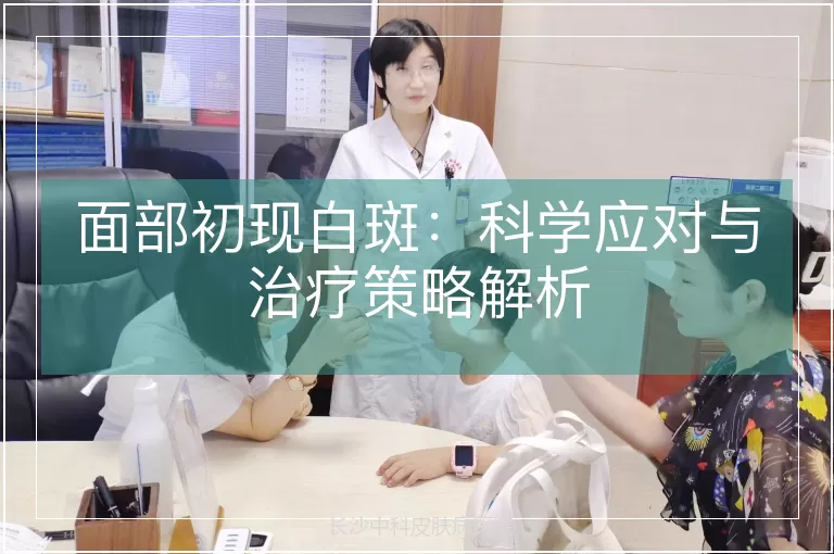 面部初现白斑：科学应对与治疗策略解析
