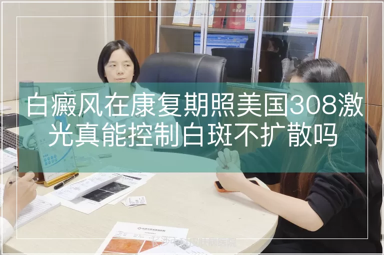 白癜风在康复期照美国308激光真能控制白斑不扩散吗