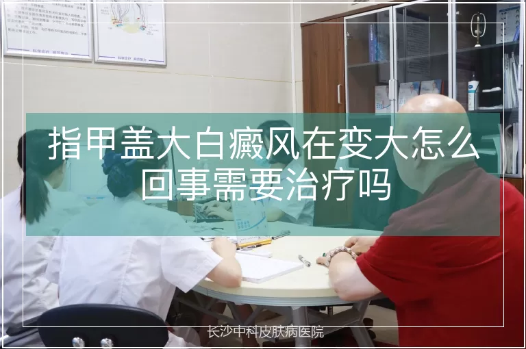 指甲盖大白癜风在变大怎么回事需要治疗吗