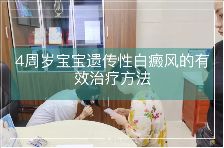 4周岁宝宝遗传性白癜风的有效治疗方法