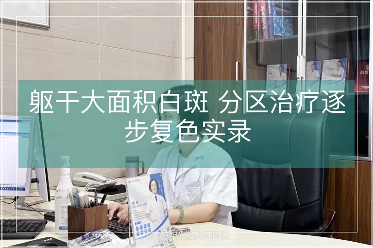 躯干大面积白斑 分区治疗逐步复色实录