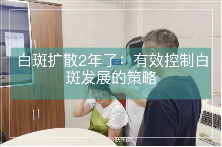 白斑扩散2年了：有效控制白斑发展的策略