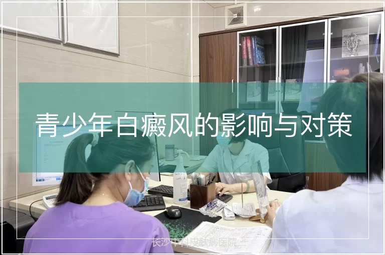 青少年白癜风的影响与对策