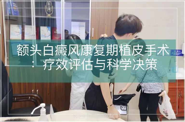 额头白癜风康复期植皮手术：疗效评估与科学决策
