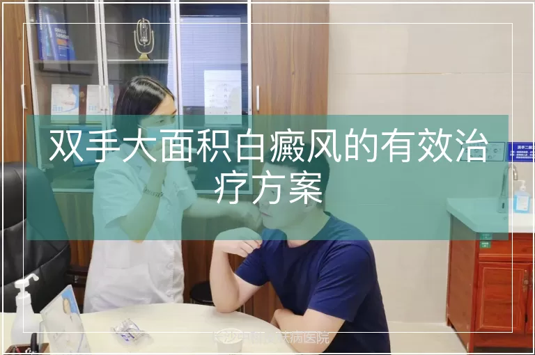 双手大面积白癜风的有效治疗方案