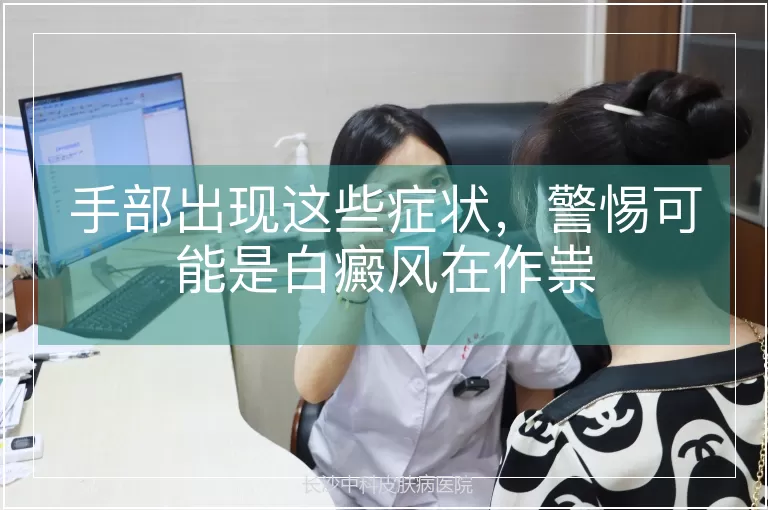 手部出现这些症状，警惕可能是白癜风在作祟
