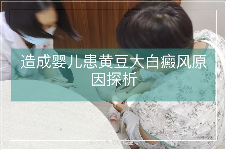 造成婴儿患黄豆大白癜风原因探析