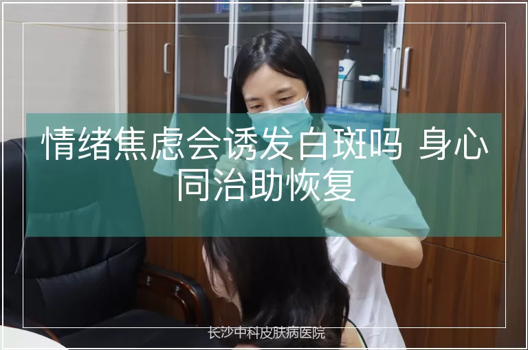 情绪焦虑会诱发白斑吗 身心同治助恢复