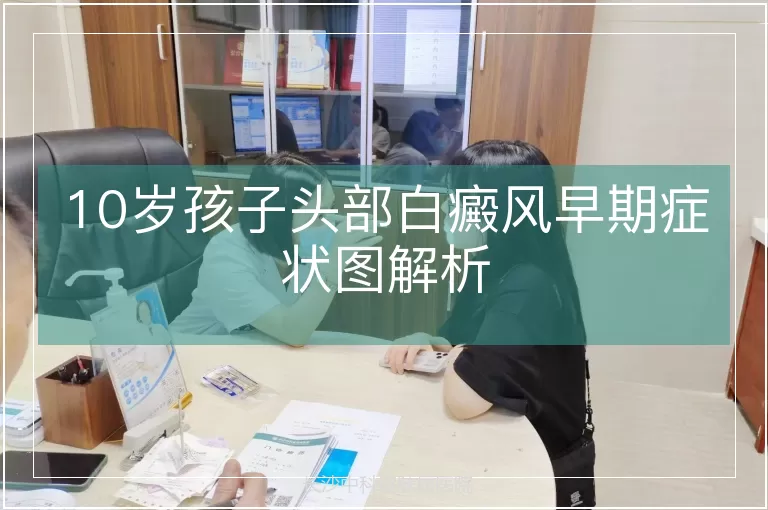 10岁孩子头部白癜风早期症状图解析