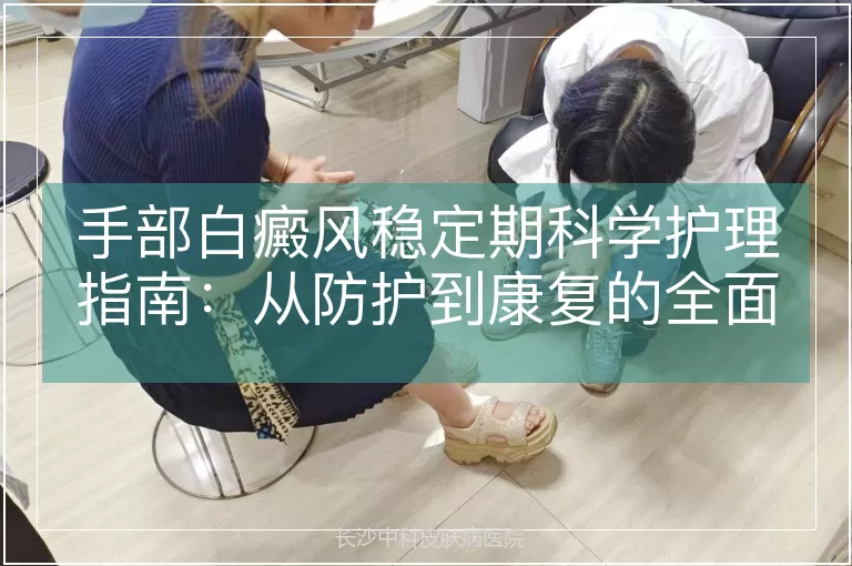 手部白癜风稳定期科学护理指南：从防护到康复的全面策略