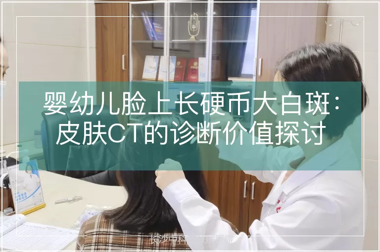 婴幼儿脸上长硬币大白斑：皮肤CT的诊断价值探讨