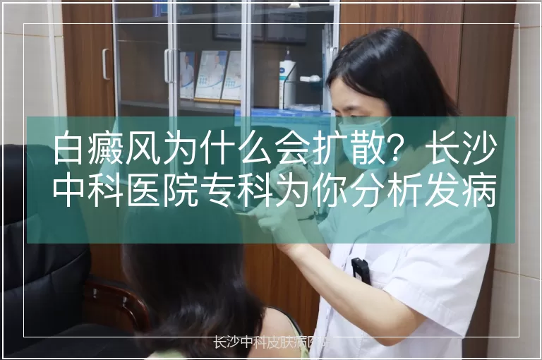 白癜风为什么会扩散？长沙中科医院专科为你分析发病诱因