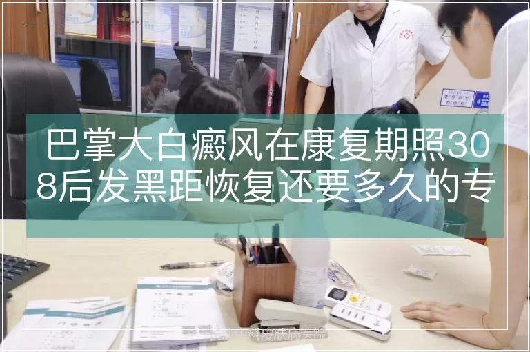 巴掌大白癜风在康复期照308后发黑距恢复还要多久的专业解析