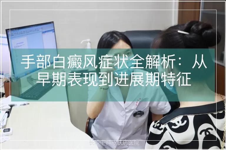 手部白癜风症状全解析：从早期表现到进展期特征