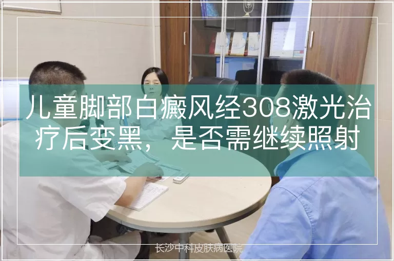 儿童脚部白癜风经308激光治疗后变黑,是否需继续照射?