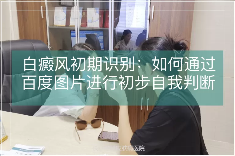白癜风初期识别：如何通过百度图片进行初步自我判断