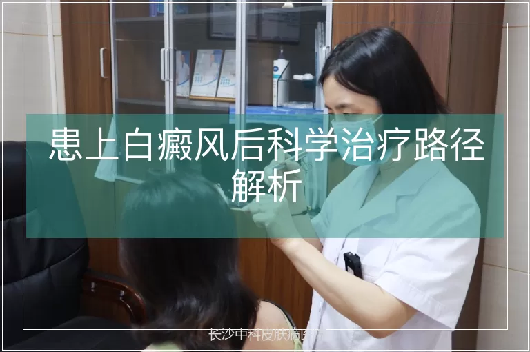 患上白癜风后科学治疗路径解析