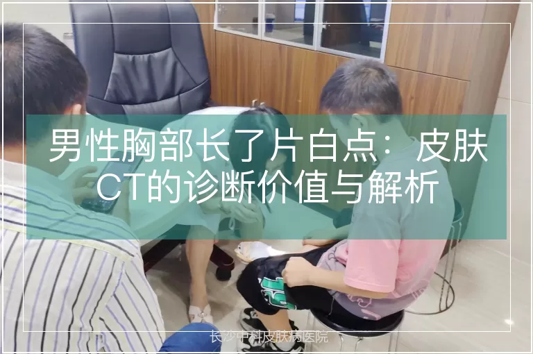 男性胸部长了片白点：皮肤CT的诊断价值与解析