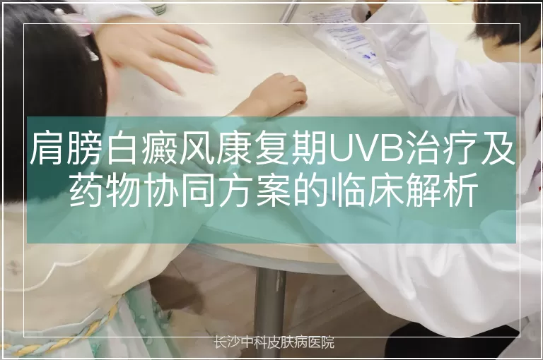 肩膀白癜风康复期UVB治疗及药物协同方案的临床解析