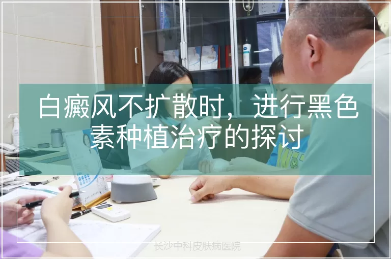 白癜风不扩散时，进行黑色素种植治疗的探讨