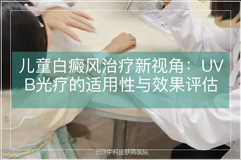 儿童白癜风治疗新视角：UVB光疗的适用性与效果评估