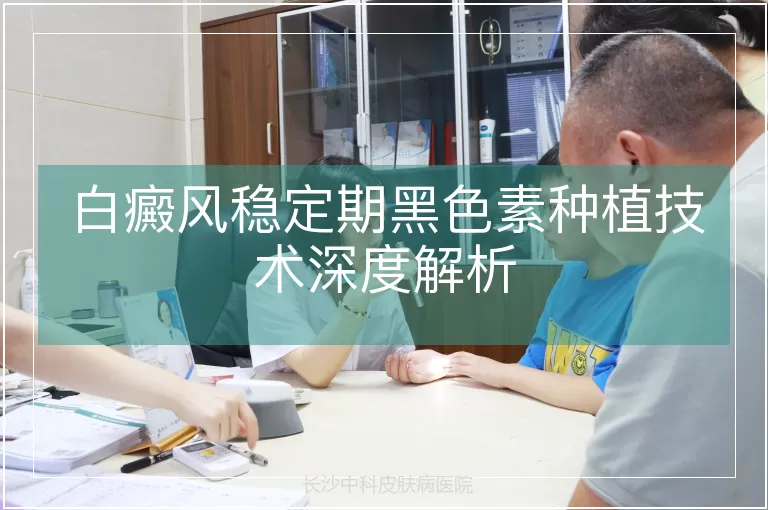 白癜风稳定期黑色素种植技术深度解析