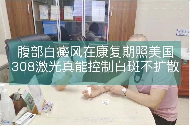 腹部白癜风在康复期照美国308激光真能控制白斑不扩散吗