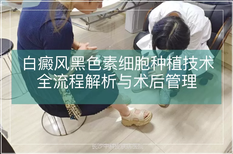 白癜风黑色素细胞种植技术全流程解析与术后管理