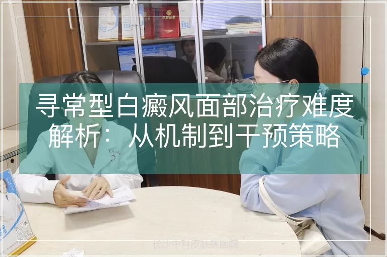 寻常型白癜风面部治疗难度解析：从机制到干预策略