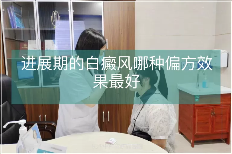 进展期的白癜风哪种偏方效果最好