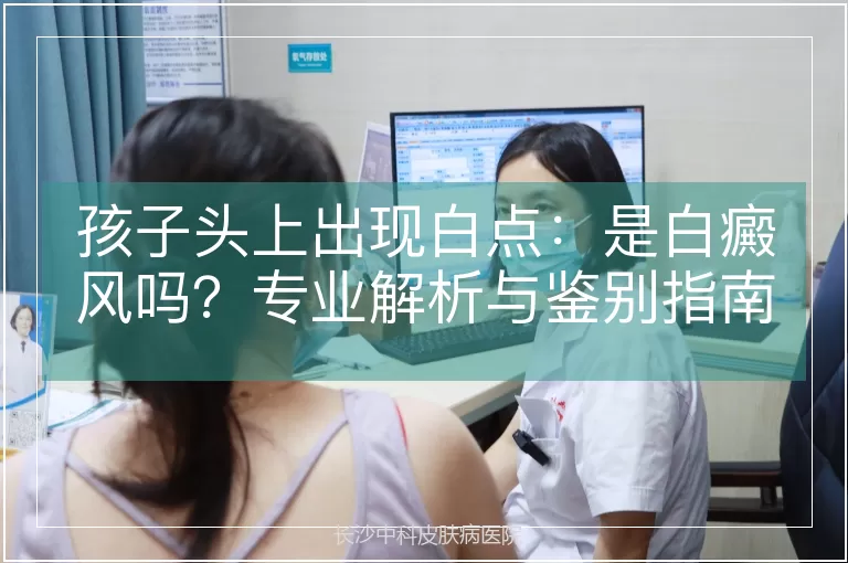 孩子头上出现白点：是白癜风吗？专业解析与鉴别指南
