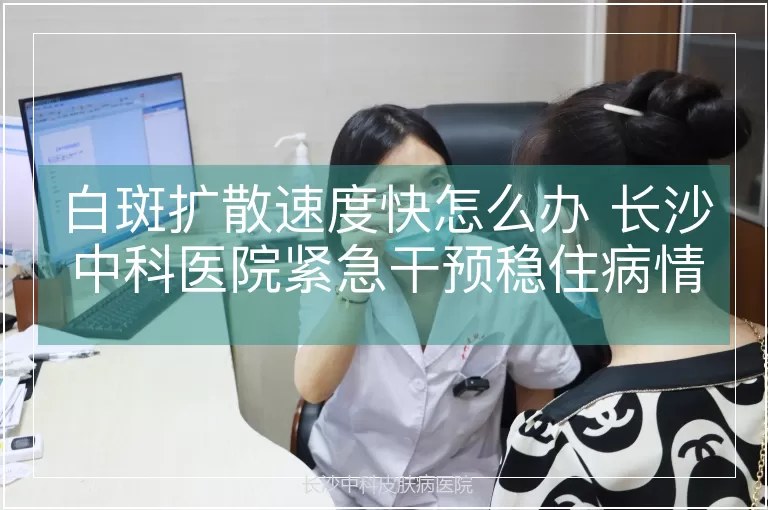 白斑扩散速度快怎么办 长沙中科医院紧急干预稳住病情