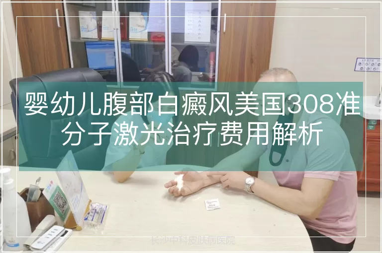 婴幼儿腹部白癜风美国308准分子激光治疗费用解析