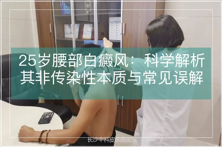 25岁腰部白癜风：科学解析其非传染性本质与常见误解