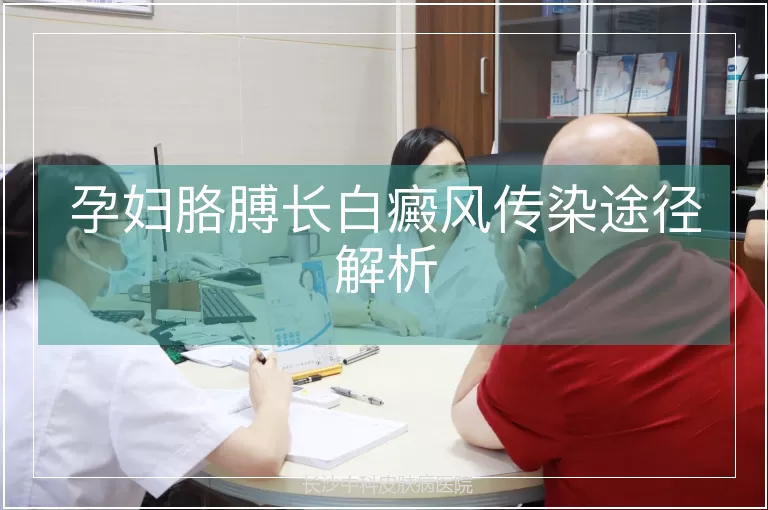 孕妇胳膊长白癜风传染途径解析