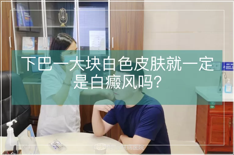 下巴一大块白色皮肤就一定是白癜风吗?