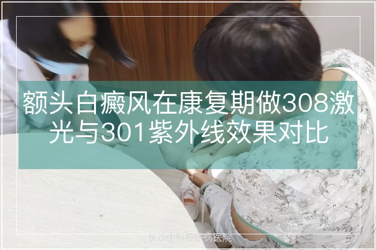 额头白癜风在康复期做308激光与301紫外线效果对比